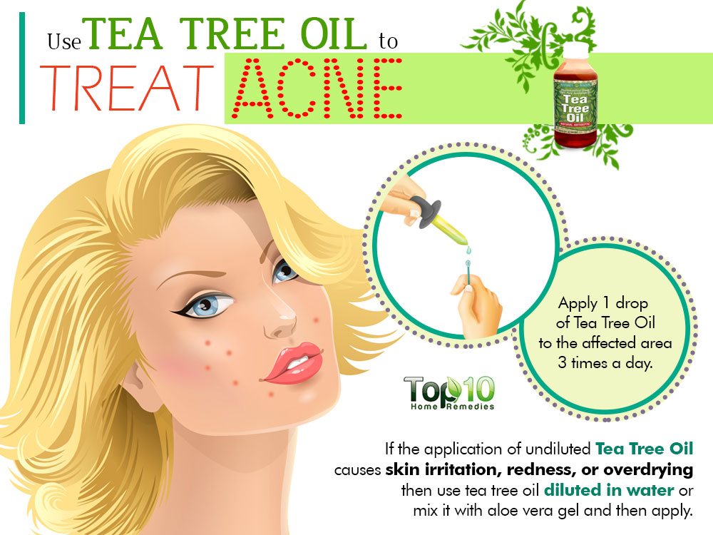 How do you treat acne?