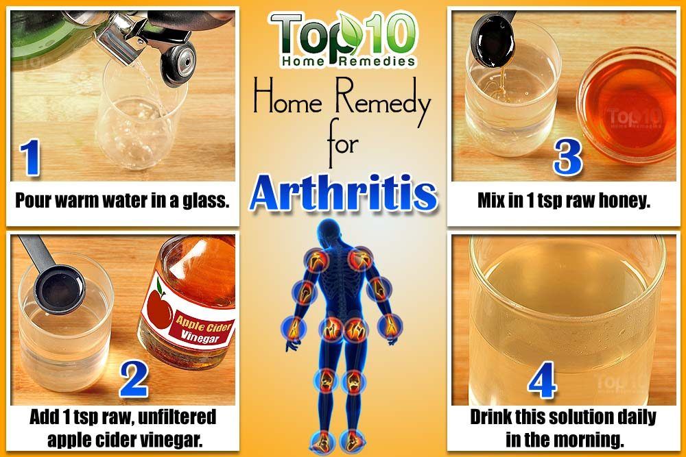 Home Remedies for Arthritis | Top 10 Home Remedies