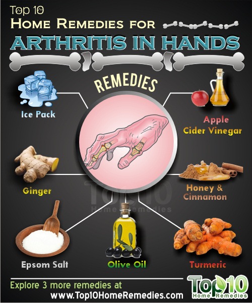 how to treat arthritis in hands and fingers