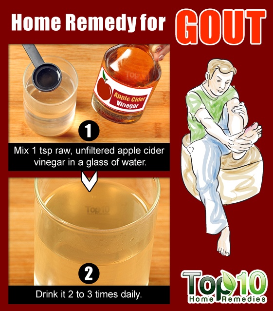 Home Remedies for Gout  Top 10 Home Remedies