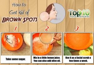 brown spots home remedy