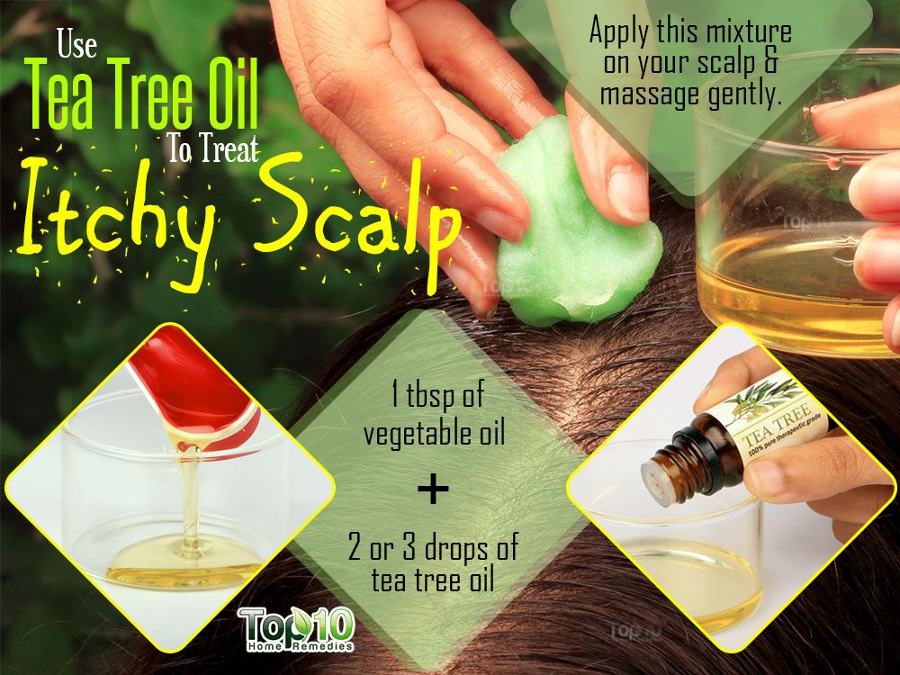 Does vinegar help an itchy scalp?