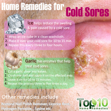 Cold Sores Causes, Remedies, Diagnosis - MedicineNet