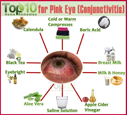 Home Remedies for Pink Eye Conjunctivitis  Top 10 Home Remedies