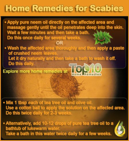 Home Remedies for Scabies | Top 10 Home Remedies