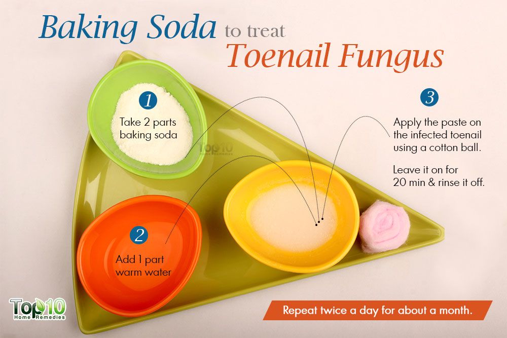 Is bleach an effective treatment for toenail fungus?