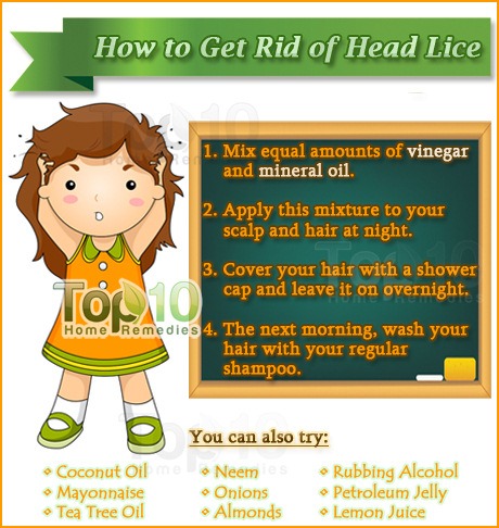 How do you kill lice and nits with vinegar?