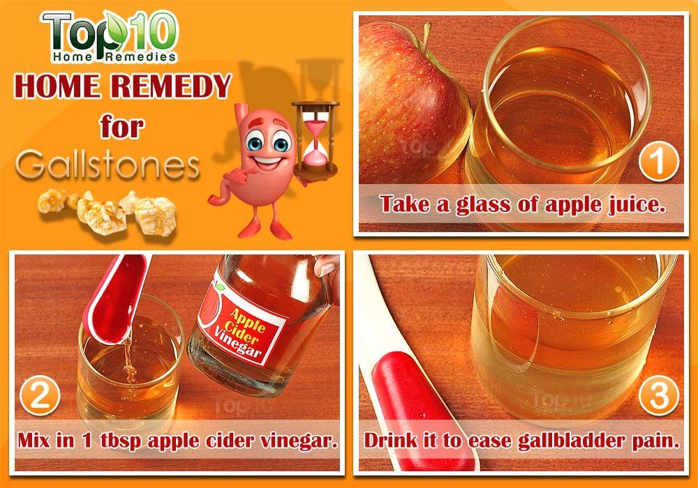 Apple Juice Diet To Remove Gallstones
