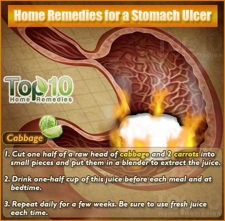 stomach ulcer remedies ulcers heal peptic gastric acid pain natural remedy treatment homemade camerons top10homeremedies ways relief symptoms icd reduce