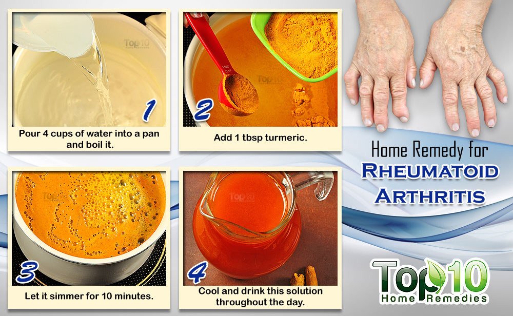What are some home remedies for arthritis?