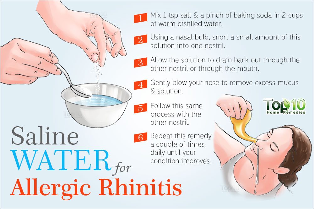 Home Remedies for Allergic Rhinitis  Top 10 Home Remedies