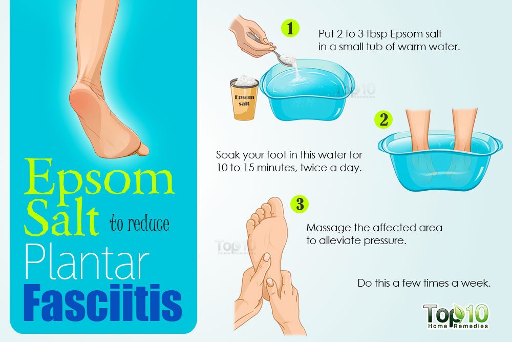 what to do for plantar fasciitis