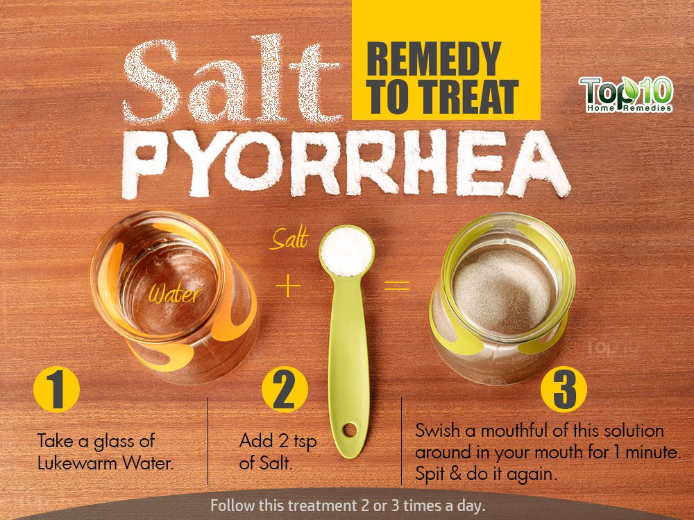 Home Remedies For Periodontitis Pyorrhea Top 10 Home Remedies