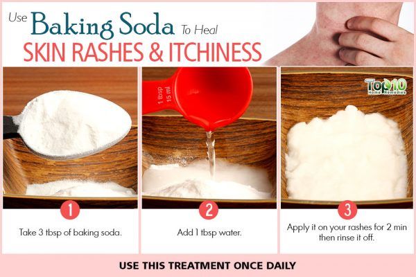 baking soda to treat skin rashes