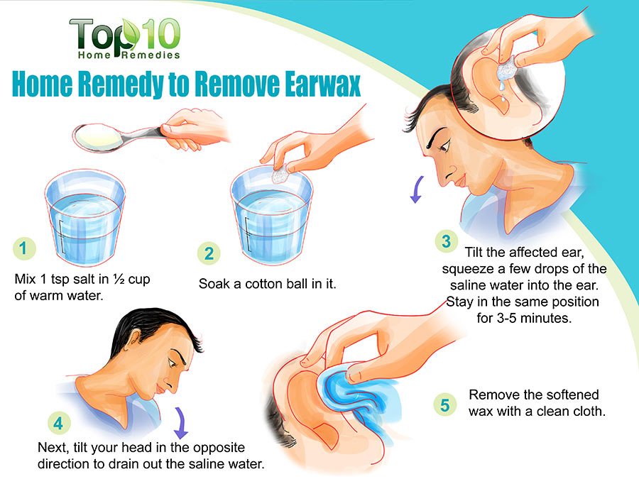 What are the best methods of home earwax removal?