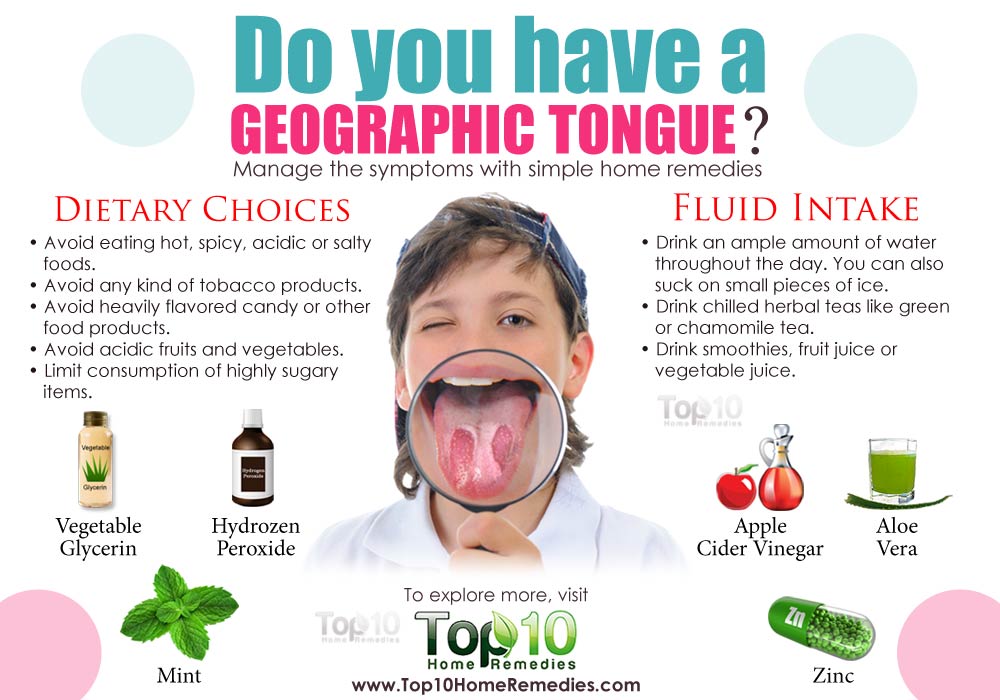 geographic tongue pain