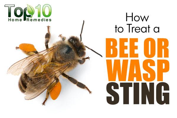 How do you treat bee stings at home?