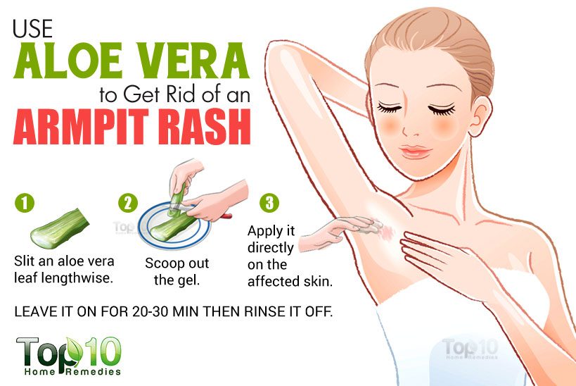 Rash Under Armpit - Causes, Treatment, Prevention, Natural ...