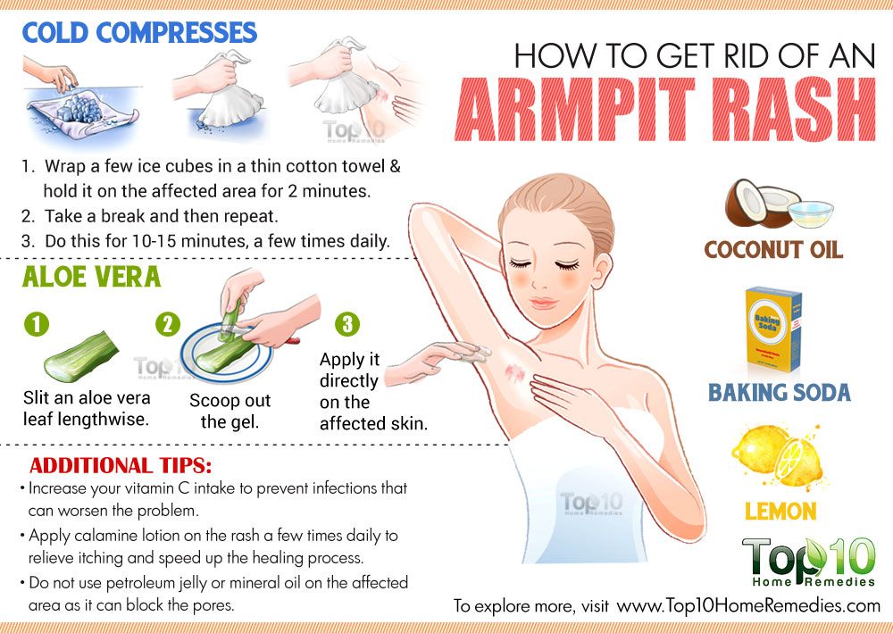 How do you treat itchy underarms?