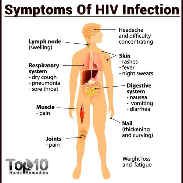 What are the signs and symptoms of HIV?
