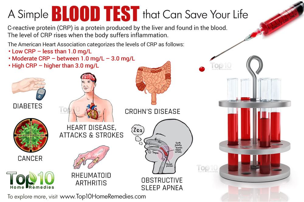 Fungal Infections - Blood, Urine & Other Lab Tests Education