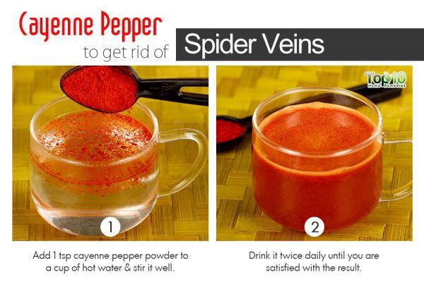 cayenne pepper to get rid of spider veins