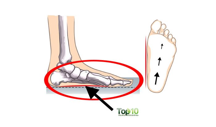 10 Reasons Why Your Feet Hurt All The Time And How To Fix It Page 3 Of 3 Top 10 Home Remedies