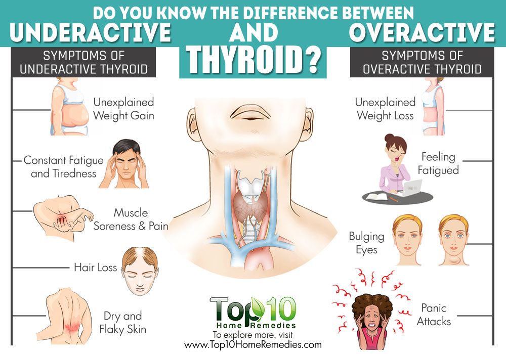 Underactive Thyroid Disease And Weight Loss