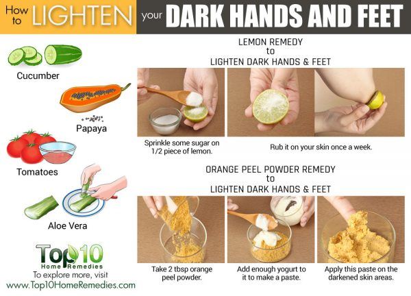how to lighten dark hands and feet