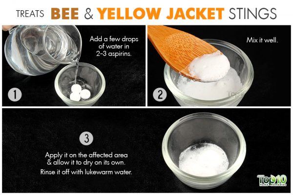 treats bee and yellow jacket stings
