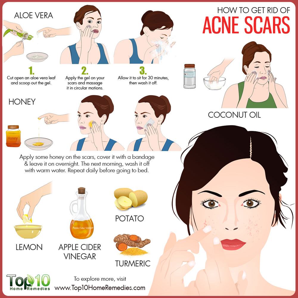 how to get rid of acne scars and dry skin