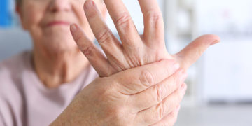 Home Remedies for Arthritis in Hands