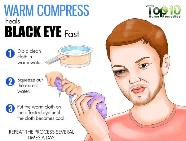 warm compress for black eye