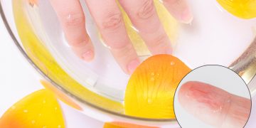 How to Get Rid of Peeling Fingertips