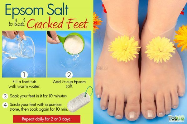 heal cracked feet with epsom salt soak