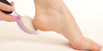 how to heal cracked feet