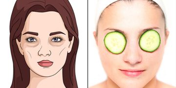 How To Get Rid Of Dark Circles as Fast as Possible