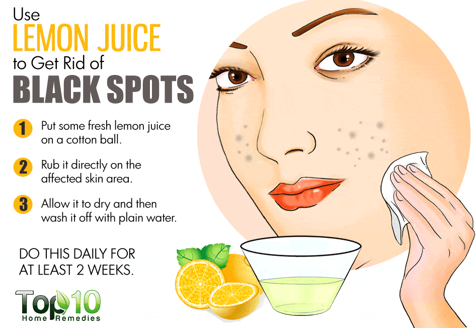 get rid of black spots on face