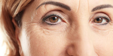 Home remedies for wrinkles