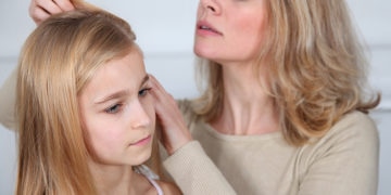 How to Get Rid of head lice