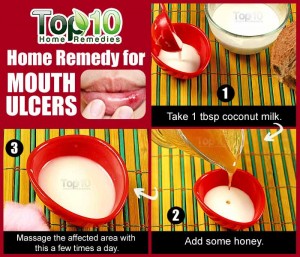 Coconut Milk for mouth ulcers