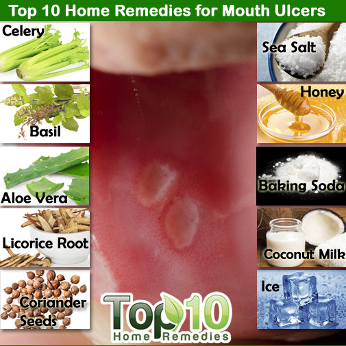 cures for mouth ulcers