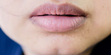 Home remedies for dark lips