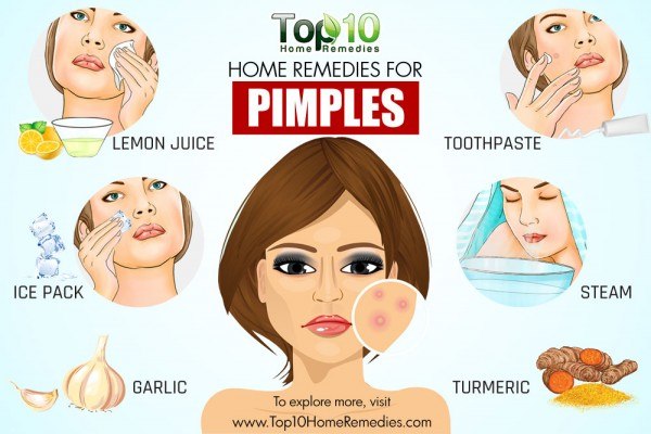 home remedies for pimples