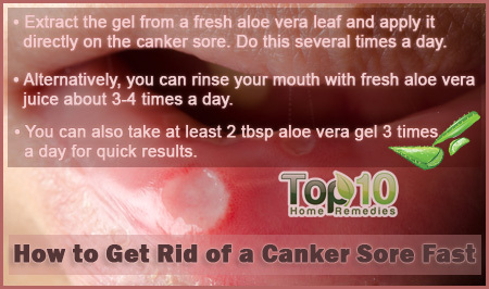 how to get rid of canker sores fat