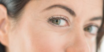 How to Get Rid of Crow’s-Feet