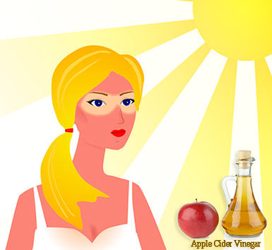 apple cider vinegar for sunburn