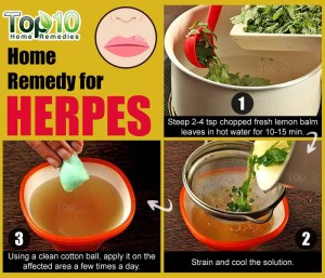 lemon balm home remedy for herpes
