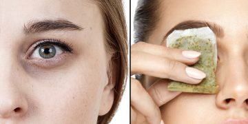 Home remedies for Dark Circles under the eyes
