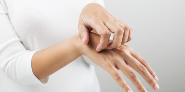 Home remedies for Rashes